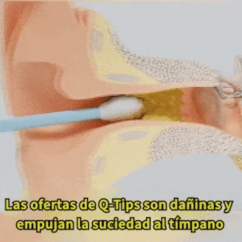 👂🧏‍♀️Kit limpiador de oídos-¿SIENTES LOS OÍDOS TAPADOS O EMPIEZAS A PERDER AUDICIÓN?
