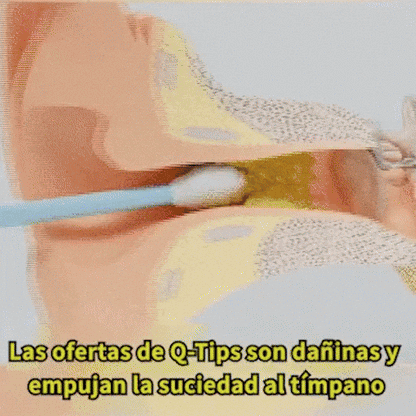 👂🧏‍♀️Kit limpiador de oídos-¿SIENTES LOS OÍDOS TAPADOS O EMPIEZAS A PERDER AUDICIÓN?